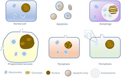 Ferroptosis: Redox Imbalance and Hematological Tumorigenesis